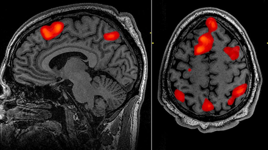 An example fMRI brain scan